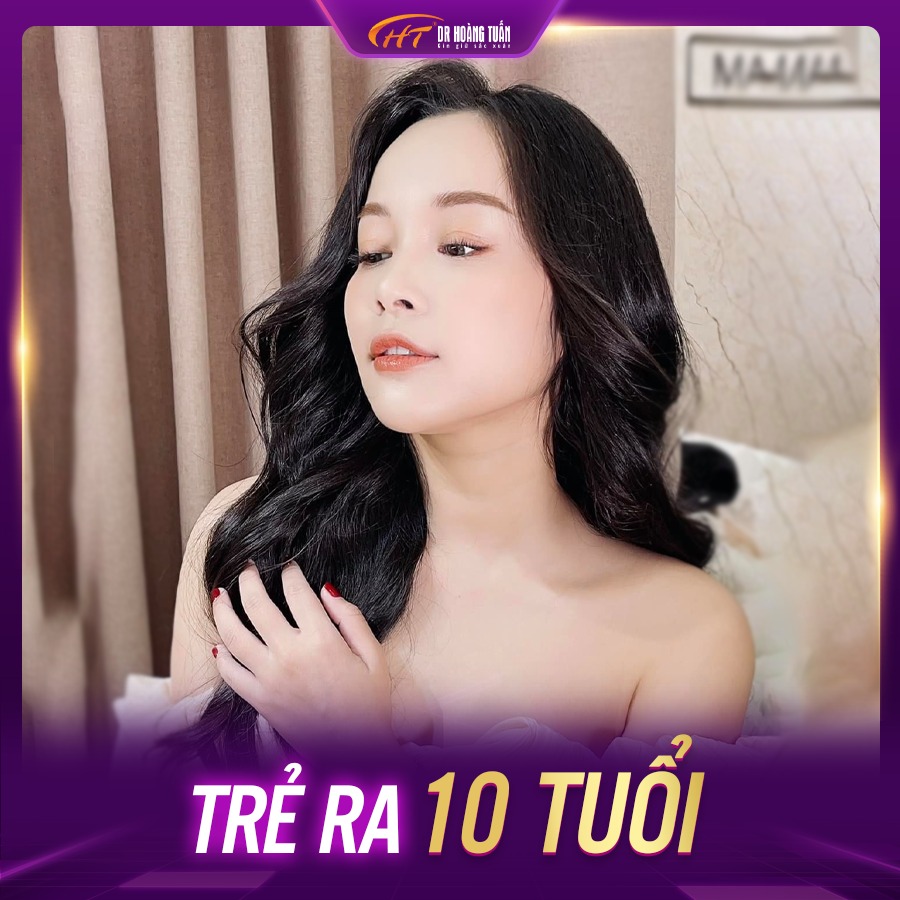 thermage giữ được bao lâu